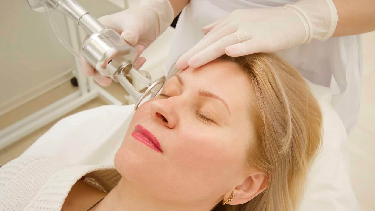 Laser treatment to rejuvenate the facial skin